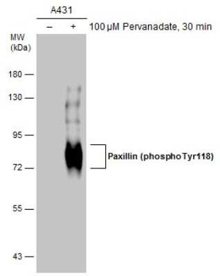 Western Blot: Paxillin [p Tyr118] Antibody [NBP3-13073]
